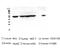T-Complex 1 antibody, M02389, Boster Biological Technology, Western Blot image 