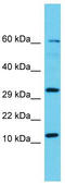 Putative uncharacterized protein C14orf181 antibody, TA331488, Origene, Western Blot image 