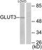 Solute carrier family 2, facilitated glucose transporter member 3 antibody, TA314539, Origene, Western Blot image 