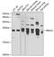 RAS Related 2 antibody, GTX64628, GeneTex, Western Blot image 