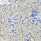 Hexokinase 3 antibody, A05145-2, Boster Biological Technology, Immunohistochemistry paraffin image 