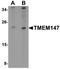 Transmembrane Protein 147 antibody, orb178866, Biorbyt, Western Blot image 