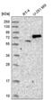 SUMO Specific Peptidase 1 antibody, NBP2-55420, Novus Biologicals, Western Blot image 