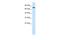 Nuclear Receptor Binding SET Domain Protein 2 antibody, A02663, Boster Biological Technology, Western Blot image 