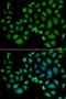 Chloride Intracellular Channel 1 antibody, LS-C335661, Lifespan Biosciences, Immunofluorescence image 