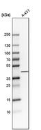 Putative MAPK-activating protein PM04/PM05/PM06/PM07 antibody, HPA009160, Atlas Antibodies, Western Blot image 