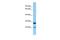 Prostaglandin E Synthase 2 antibody, PA5-45733, Invitrogen Antibodies, Western Blot image 