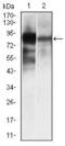 Alkaline Phosphatase, Biomineralization Associated antibody, GTX60568, GeneTex, Western Blot image 
