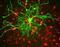 Neurofilament Light antibody, A02482, Boster Biological Technology, Immunohistochemistry paraffin image 
