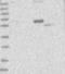 Sec1 Family Domain Containing 2 antibody, NBP1-81925, Novus Biologicals, Western Blot image 