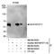 Lysine Acetyltransferase 8 antibody, NB100-55252, Novus Biologicals, Immunoprecipitation image 