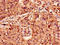Apoptotic Peptidase Activating Factor 1 antibody, LS-C375229, Lifespan Biosciences, Immunohistochemistry paraffin image 