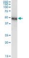 Nuclear Receptor Subfamily 2 Group F Member 1 antibody, H00007025-M01, Novus Biologicals, Western Blot image 
