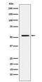 Matrix Metallopeptidase 1 antibody, M00733-2, Boster Biological Technology, Western Blot image 