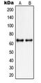 Protein Inhibitor Of Activated STAT 3 antibody, LS-C353250, Lifespan Biosciences, Western Blot image 