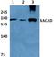 NAC Alpha Domain Containing antibody, A15919-1, Boster Biological Technology, Western Blot image 