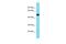 Transmembrane Protein 39A antibody, PA5-70924, Invitrogen Antibodies, Western Blot image 