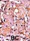 RAD9 Checkpoint Clamp Component A antibody, abx031903, Abbexa, Immunohistochemistry frozen image 