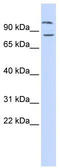 Diacylglycerol Lipase Beta antibody, TA333527, Origene, Western Blot image 