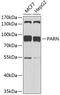 Poly(A)-Specific Ribonuclease antibody, 19-242, ProSci, Western Blot image 