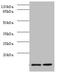 Serum Amyloid A1 antibody, A52372-100, Epigentek, Western Blot image 