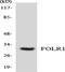 Folate Receptor Alpha antibody, A02254, Boster Biological Technology, Western Blot image 