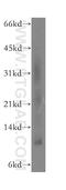 Selenoprotein K antibody, 12561-1-AP, Proteintech Group, Western Blot image 