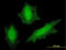 Von Hippel-Lindau Tumor Suppressor antibody, LS-C198428, Lifespan Biosciences, Immunofluorescence image 