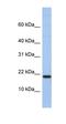 C1D Nuclear Receptor Corepressor antibody, orb330617, Biorbyt, Western Blot image 