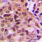 Phosphatase And Tensin Homolog antibody, LS-C358841, Lifespan Biosciences, Immunohistochemistry paraffin image 