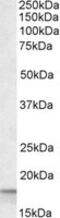 Peptidylprolyl Isomerase A antibody, MBS420056, MyBioSource, Western Blot image 