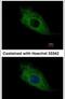 TMEM66 antibody, PA5-31588, Invitrogen Antibodies, Immunofluorescence image 