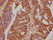 Proprotein Convertase Subtilisin/Kexin Type 9 antibody, CSB-PA017647LA01HU, Cusabio, Immunohistochemistry frozen image 