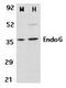 Endonuclease G antibody, GTX10522, GeneTex, Western Blot image 