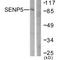 Sentrin-specific protease 5 antibody, A08574, Boster Biological Technology, Western Blot image 