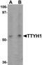 Tweety Family Member 1 antibody, NBP2-81944, Novus Biologicals, Western Blot image 