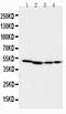 Mitogen-Activated Protein Kinase Kinase 1 antibody, PA1376, Boster Biological Technology, Western Blot image 