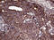 Autophagy Related 4B Cysteine Peptidase antibody, M02885-1, Boster Biological Technology, Immunohistochemistry paraffin image 