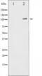 Nuclear Factor Kappa B Subunit 1 antibody, TA325720, Origene, Western Blot image 