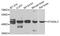 Lactosylceramide alpha-2,3-sialyltransferase antibody, A06219, Boster Biological Technology, Western Blot image 