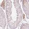 Progestin And AdipoQ Receptor Family Member 9 antibody, HPA052798, Atlas Antibodies, Immunohistochemistry frozen image 