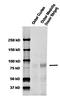 ENaC-Alpha antibody, orb67567, Biorbyt, Western Blot image 