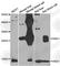 Hemoglobin Subunit Alpha 2 antibody, A7322, ABclonal Technology, Western Blot image 