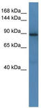 SLIT-ROBO Rho GTPase Activating Protein 1 antibody, TA344767, Origene, Western Blot image 