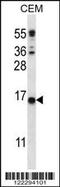 Transmembrane Protein 254 antibody, 56-452, ProSci, Western Blot image 