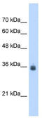 Stromal Cell Derived Factor 4 antibody, TA342002, Origene, Western Blot image 