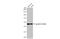 Tubulin Gamma 2 antibody, GTX636480, GeneTex, Western Blot image 