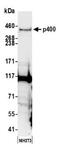 E1A Binding Protein P400 antibody, NB200-210, Novus Biologicals, Western Blot image 