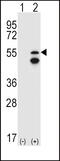 Fyn Related Src Family Tyrosine Kinase antibody, 63-160, ProSci, Western Blot image 