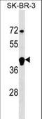 F-Box And Leucine Rich Repeat Protein 12 antibody, LS-C159627, Lifespan Biosciences, Western Blot image 